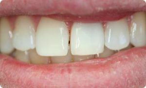 Post bleach_opt(1)