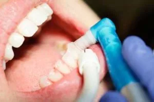 patient getting their teeth cleaned at Center for Cosmetic Dentistry