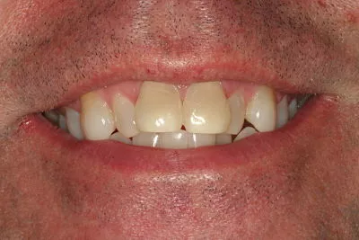 Before image