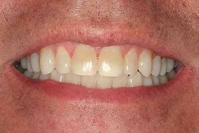 After image